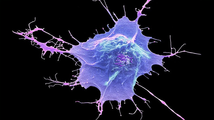 کارآزمایی های پیشگامانه سلولهای بنیادی در ژاپن نتایج اولیه امیدوارکننده ای را گزارش میدهند